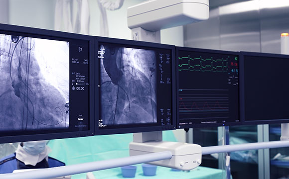 Coronary Angiography scan