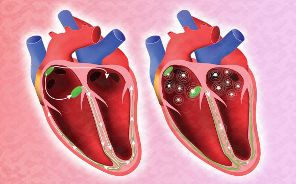 heart diagram