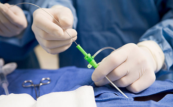 surgery performing cardiac catheterization